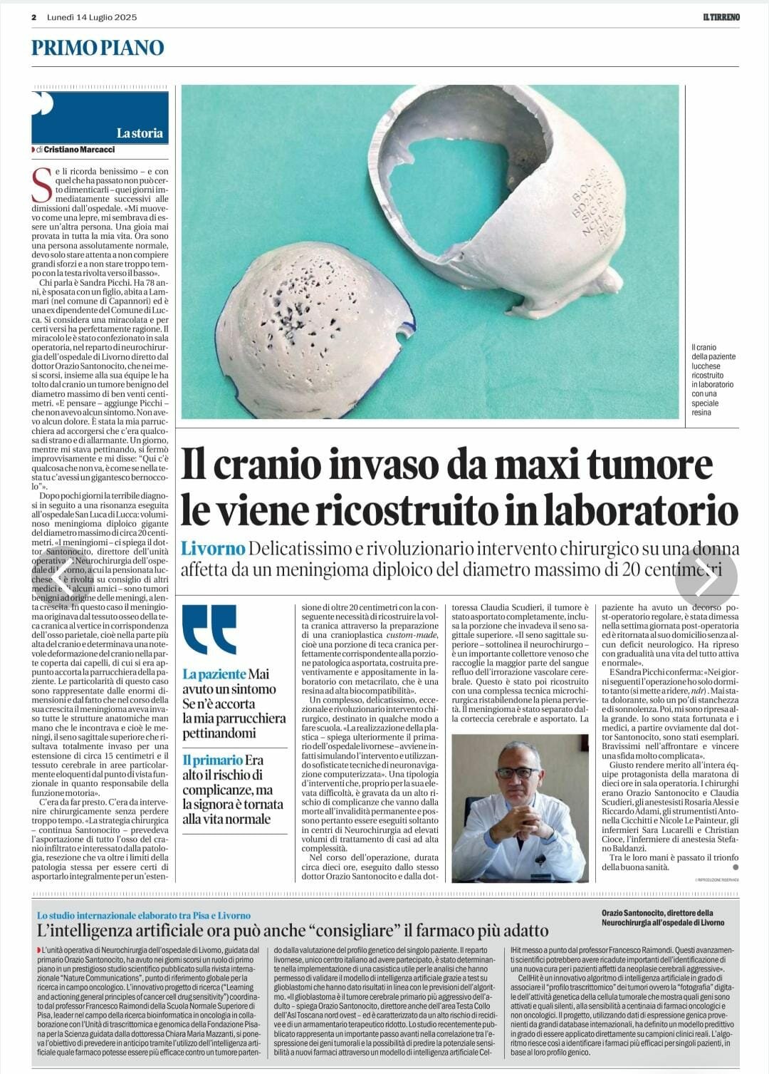 Il cranio invaso da maxi tumore le viene ricostruito in laboratorio Il cranio invaso da maxi tumore le viene ricostruito in laboratorio