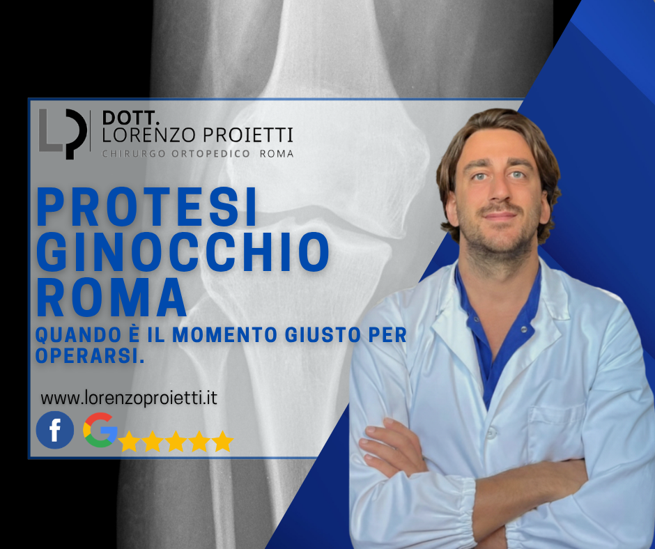 ortopedico ginocchio roma