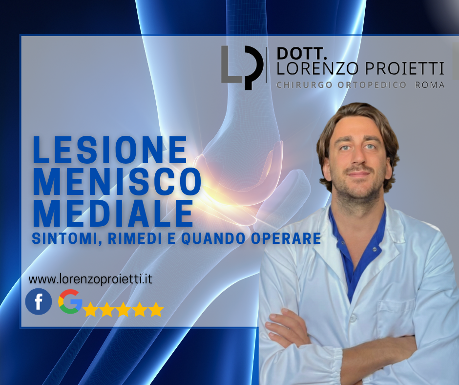 Lesione del Menisco Mediale (Menisco Interno): Sintomi, Cura e Quando Operare