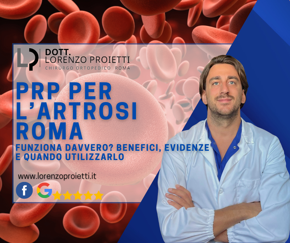 PRP per l’Artrosi: Funziona Davvero? Benefici, Evidenze e Quando Utilizzarlo