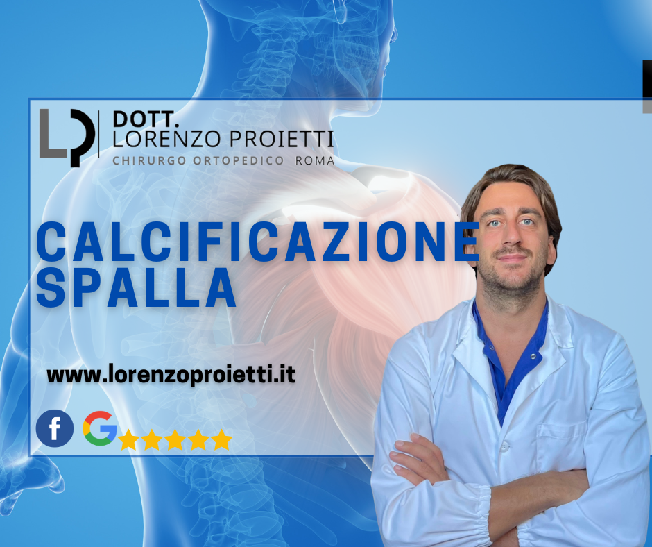Calcificazione alla Spalla: Sintomi, Cause, Cure e Quando Serve l’Intervento