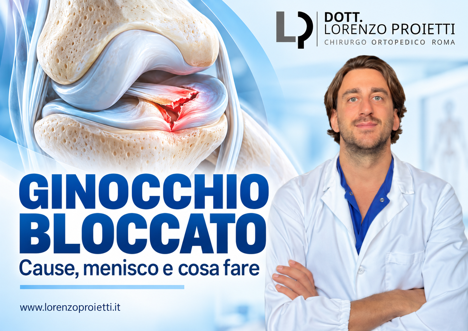 Ginocchio Bloccato: Cause e Cosa Fare per Sbloccarlo