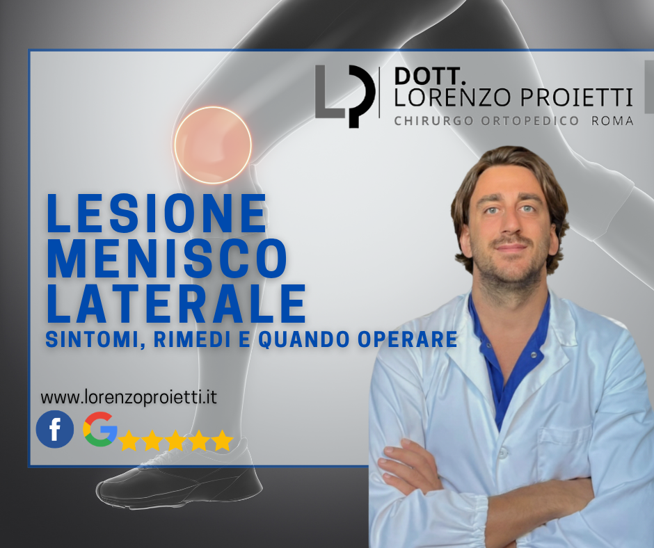 Lesione Menisco Laterale: Sintomi, Cura e Quando Operare