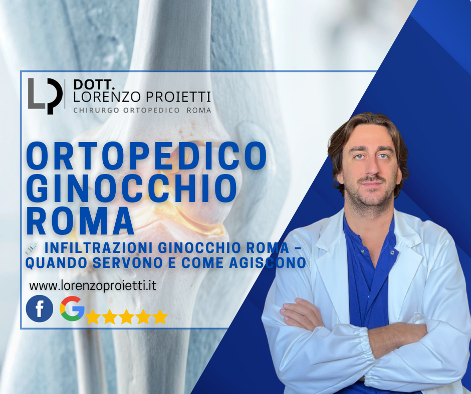 💉 Infiltrazioni Ginocchio Roma – Quando Servono e Come Agiscono