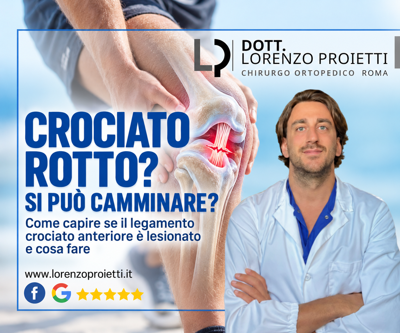 Crociato Rotto: Si Può Camminare? Come Capire se il Legamento Crociato Anteriore è Lesionato e Cosa Fare