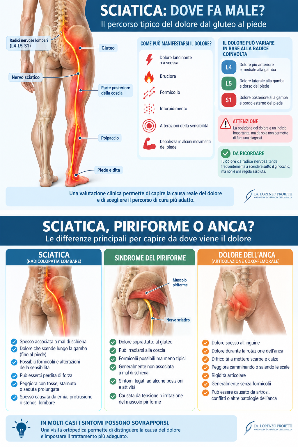 dolore sciatica
