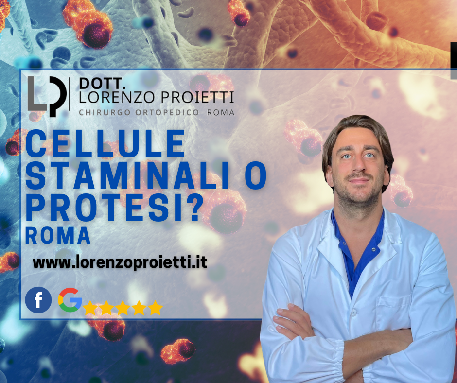 Cellule Staminali o Protesi? Quando Funzionano Davvero e Quando Serve Operarsi