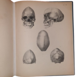 dr-hermann-welcker-untersuchungen-uber-wachsthum-und-bau-des-menschlichen-schadels-leipzig-verlag-von-wilhelm-engelmann-1862