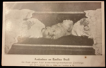 andenken-an-emilisa-stoll-die-kopf-zusammengewachsenen-zwilinge-geb-am-7-januar-1912-zu-vilbel-bei-frankfurt-a-m