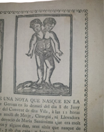 teratologia-relazione-di-una-bambina-con-due-teste-nata-a-bisbal-l-8-giugno-1801