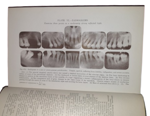 sir-james-frank-colier-dental-surgery-and-pathology-london-longmans-green-and-co-1923