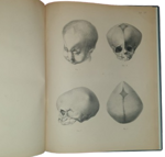 dr-hermann-welcker-untersuchungen-uber-wachsthum-und-bau-des-menschlichen-schadels-leipzig-verlag-von-wilhelm-engelmann-1862