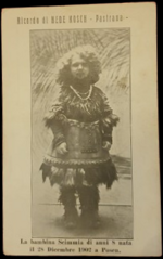 ricordo-di-hede-kosch-pastrana-la-bambina-scimmia-di-anni-8-nata-il-28-dicembre-1902-a-posen