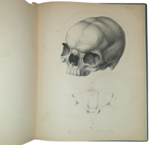 dr-hermann-welcker-untersuchungen-uber-wachsthum-und-bau-des-menschlichen-schadels-leipzig-verlag-von-wilhelm-engelmann-1862