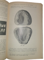 sir-james-frank-colier-dental-surgery-and-pathology-london-longmans-green-and-co-1923