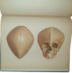 dr-hermann-welcker-untersuchungen-uber-wachsthum-und-bau-des-menschlichen-schadels-leipzig-verlag-von-wilhelm-engelmann-1862