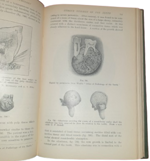 sir-james-frank-colier-dental-surgery-and-pathology-london-longmans-green-and-co-1923