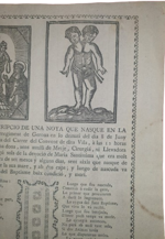 teratologia-relazione-di-una-bambina-con-due-teste-nata-a-bisbal-l-8-giugno-1801