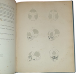 dr-hermann-welcker-untersuchungen-uber-wachsthum-und-bau-des-menschlichen-schadels-leipzig-verlag-von-wilhelm-engelmann-1862