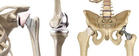 Fisio-Movimento - Studio Fisioterapico - Fisioterapista per Riabilitazione Post Protesica - Mestre e Treviso