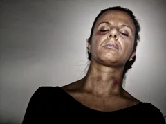 studio photograph, a girl who has been beaten and is covered in bruises 