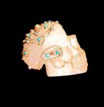 teschio-cristallo-di-rocca-turchesecorallolapislazzulo