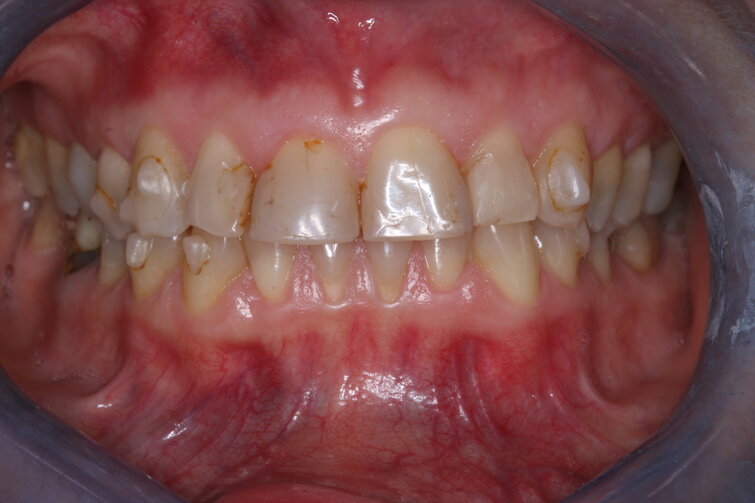 1 prima dell intervento.jpeg