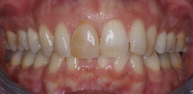 0 prima dell intervento.jpeg