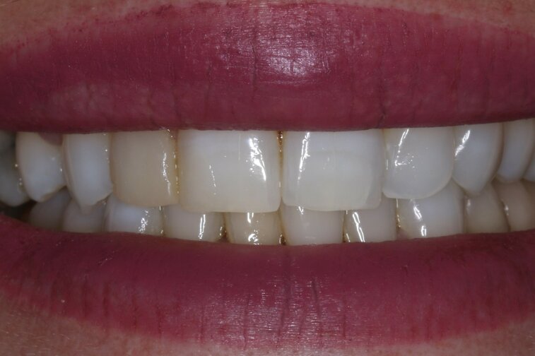 0 prima dell intervento.jpeg