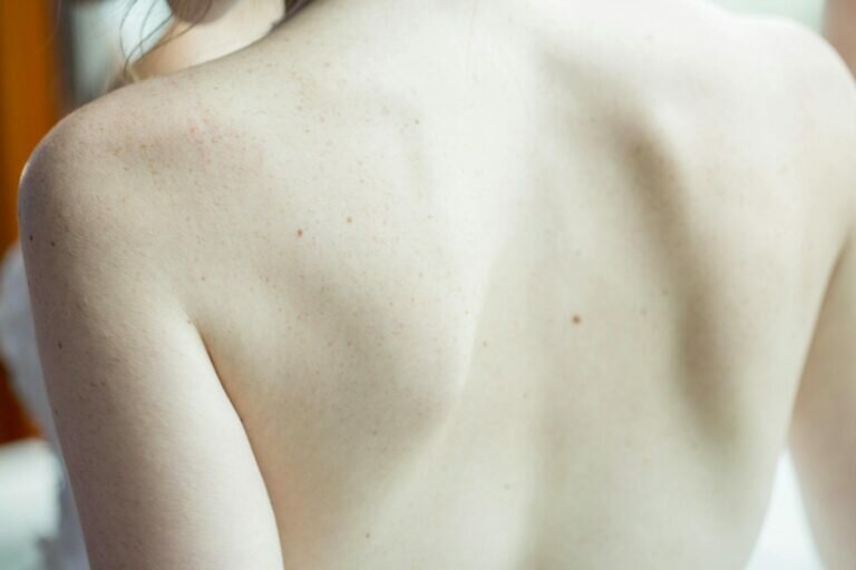 generica-schiena-dermatologia-768x512.jpeg
