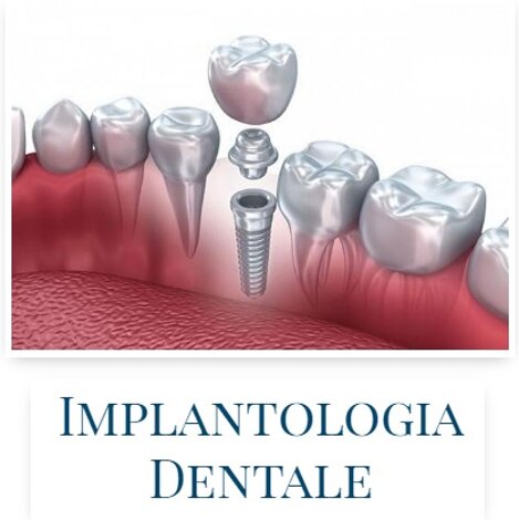 6_protesi.jpeg 6_protesi.jpeg