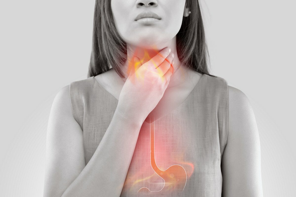 Reflusso Gastroesofageo Notturno Come la Rete Elettrica Aiuta