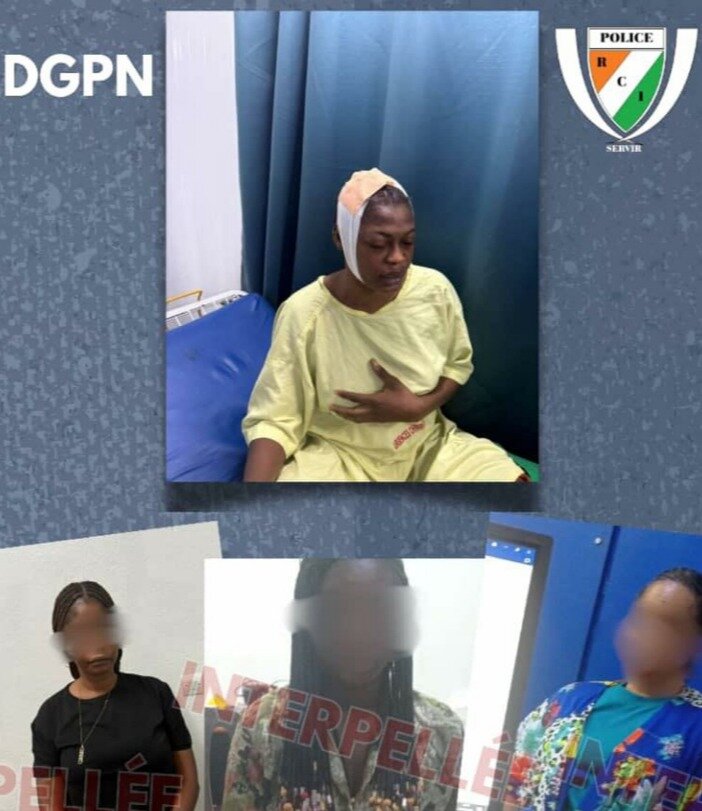 La tiktokeuse Aurélie Fatiga fracassée à coups d’objet contondant, trois femmes aux arrêts !