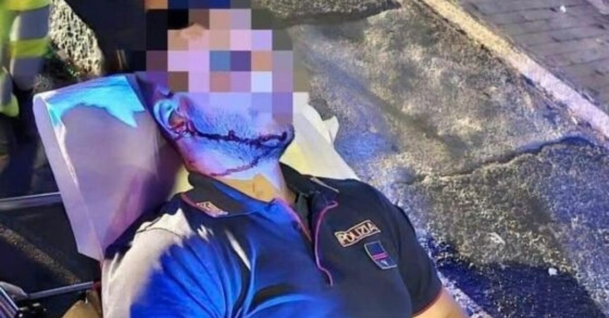 Catania violenta: 3 poliziotti aggrediti a San Cristoforo