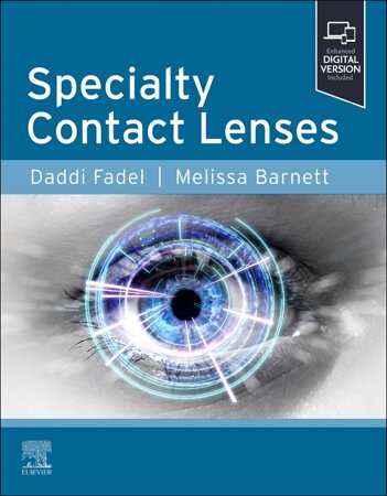 specialty contact lenses 1st edition cover.jpeg
