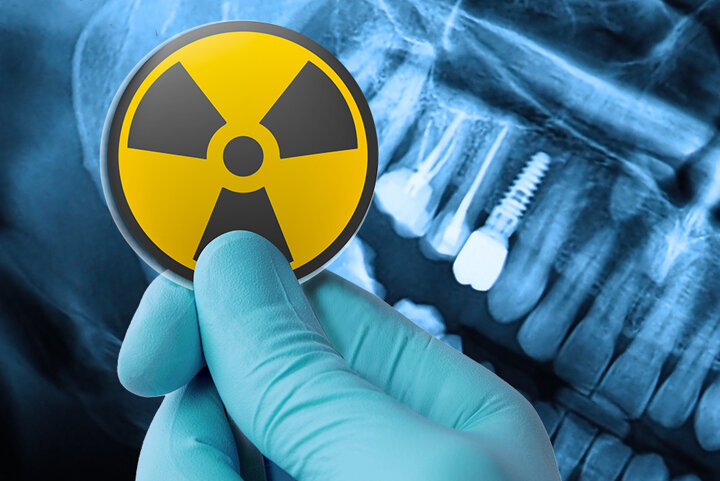 radioprotezione.jpeg radioprotezione.jpeg