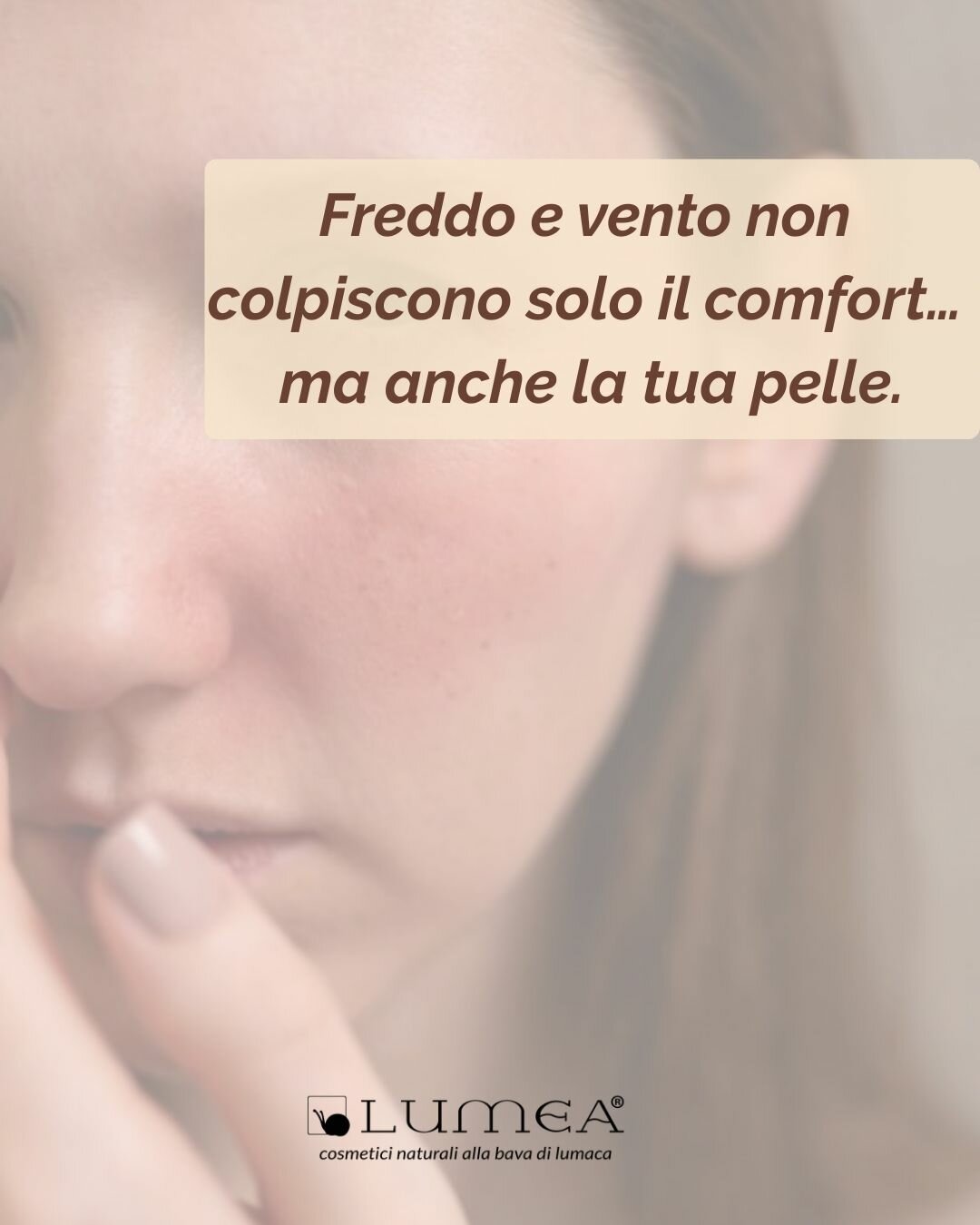 Freddo, pelle che tira e rossori: cosa succede davvero (e come aiutarla)