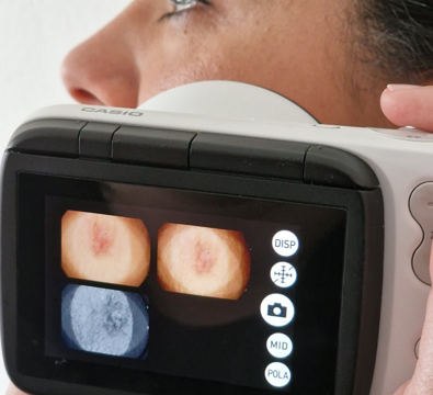 dermatoscopio%20farmacia