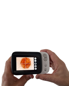 dermatoscopio teledermatologia farmacia