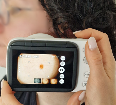 dermatoscopio