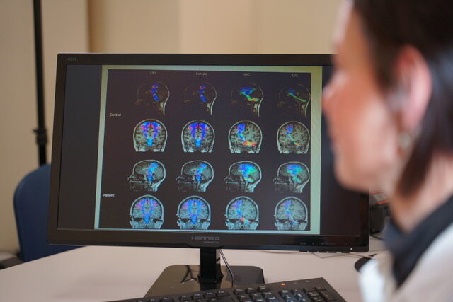 Sclerosi multipla: AISM lancia in Sicilia una piattaforma che unisce cura e dati in tempo reale