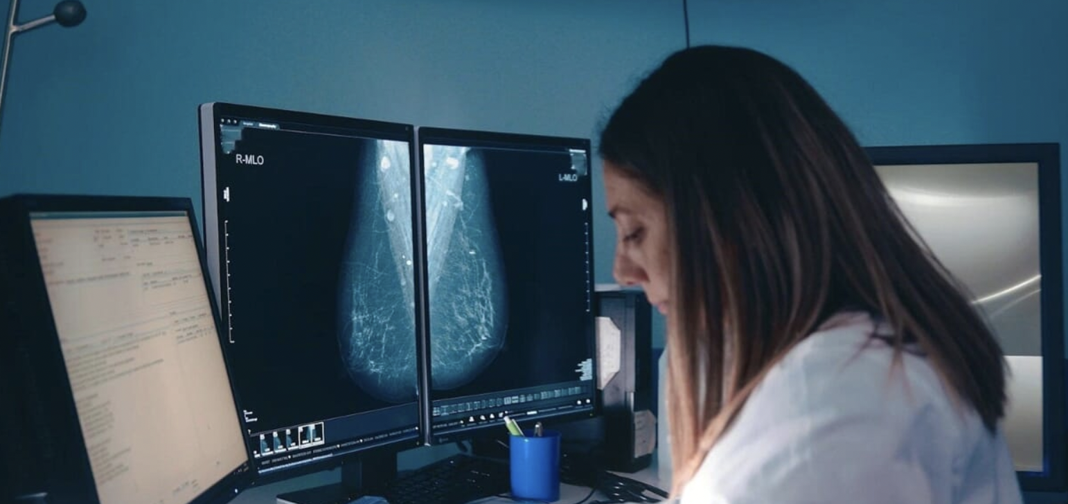 ASP di Catania: la prevenzione oncologica non va in vacanza