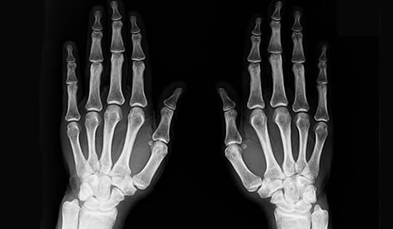 patologie-mano.jpeg