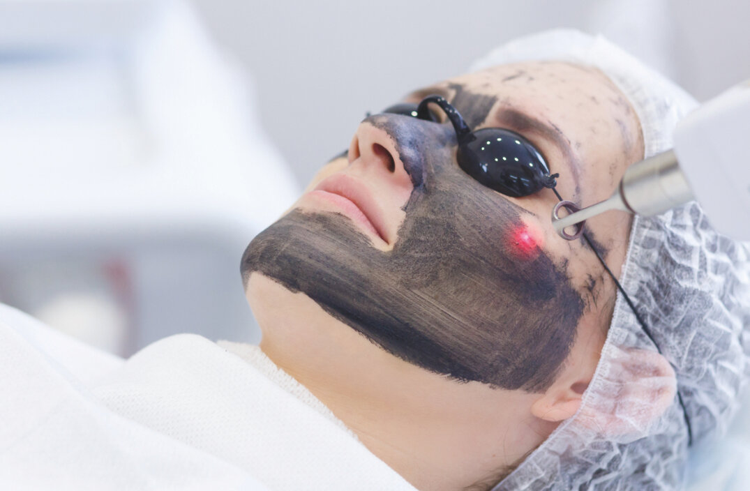 Carbon Pell Napoli