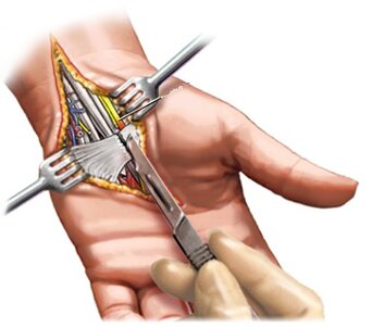 19250.jpeg 19250.jpeg