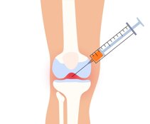 knee-injection-concept-vector-37070819.jpeg knee-injection-concept-vector-37070819.jpeg