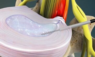 eovdzcewsae_qof.jpeg eovdzcewsae_qof.jpeg