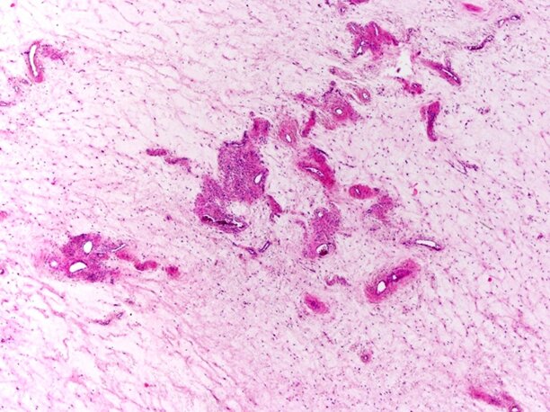 aam 2.jpeg