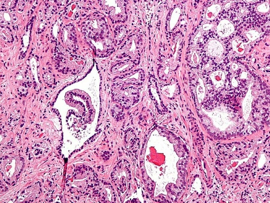 Dal corpo alla cellula: Anatomia. Patologia. La biopoesia di Gaetano Giuseppe Magro