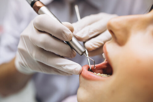 Prevenzione per il tuo sorriso Prevenzione per il tuo sorriso